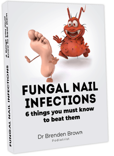 Fungal Nail Infection Report