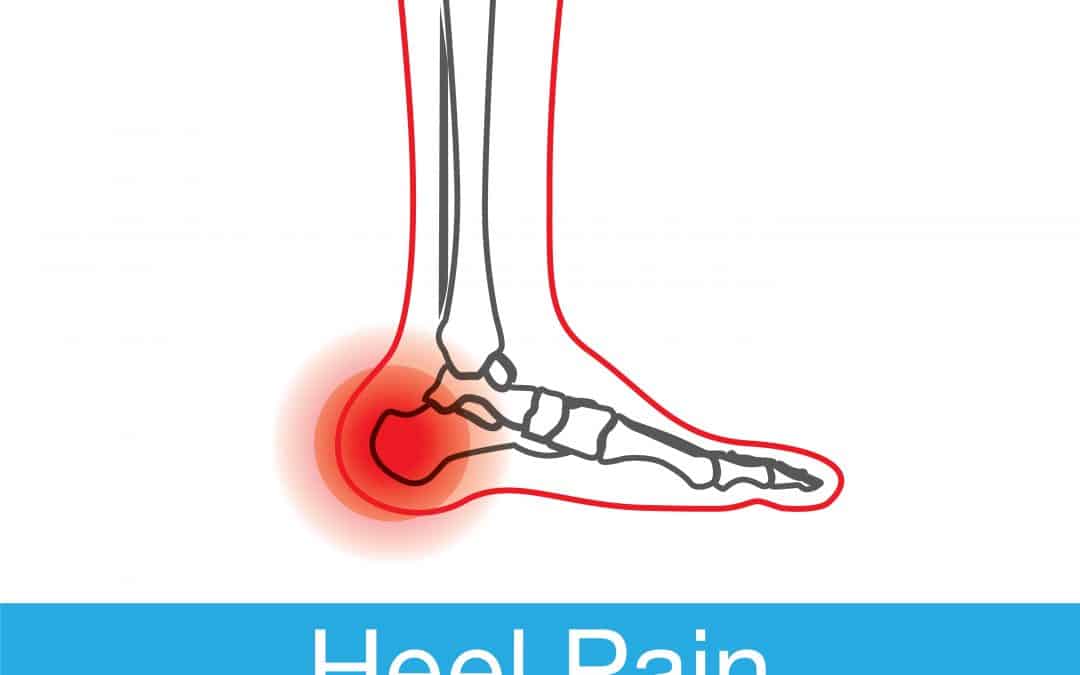 Dr Foot’s favourite treatments for heel pain