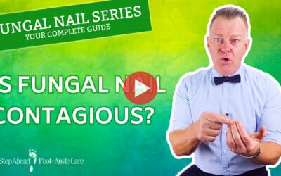 Are Fungal Nails Contagious? – Fungal Nail Series