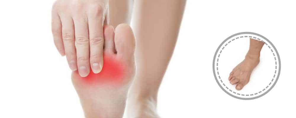 Is All Heel Pain Plantar Fasciitis?