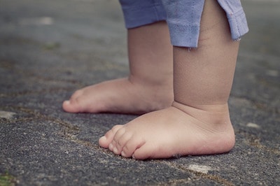 Taking care of common kids’ foot complaints