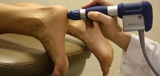 Why is your shockwave therapy not stopping your heel pain?