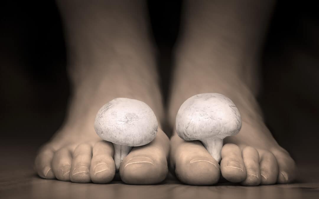 Unmasking Fungal Nails: Your Guide to Understanding and Treating Onychomycosis